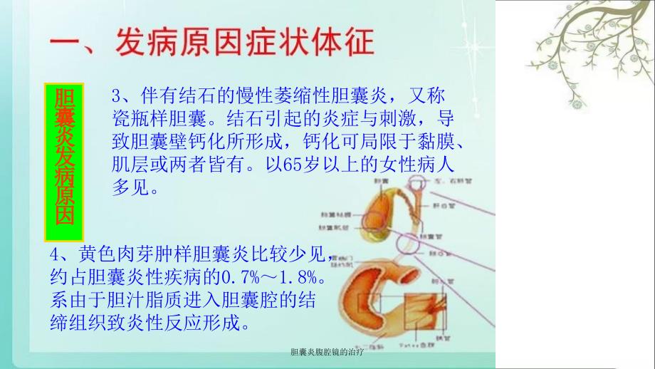 胆囊炎腹腔镜的治疗课件_第4页