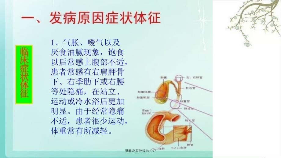 胆囊炎腹腔镜的治疗课件_第5页