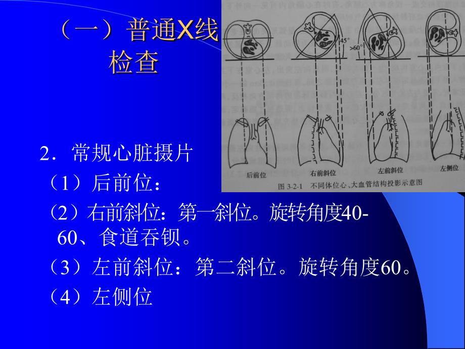 医学超级全影像学考试重点循环系统临床.ppt_第4页