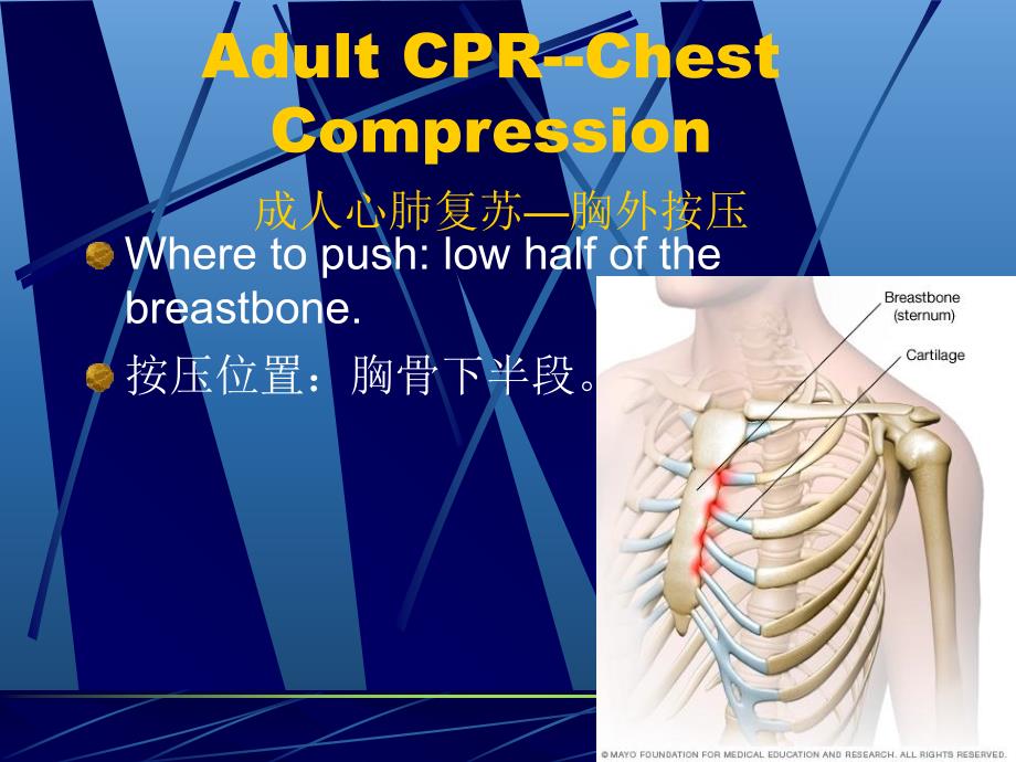 心肺复苏及基础急救培训讲义_第3页