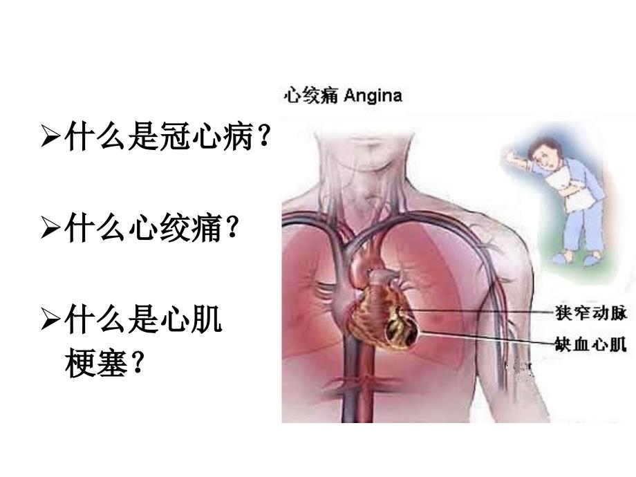 冠心病健康讲座PPT课件_第3页