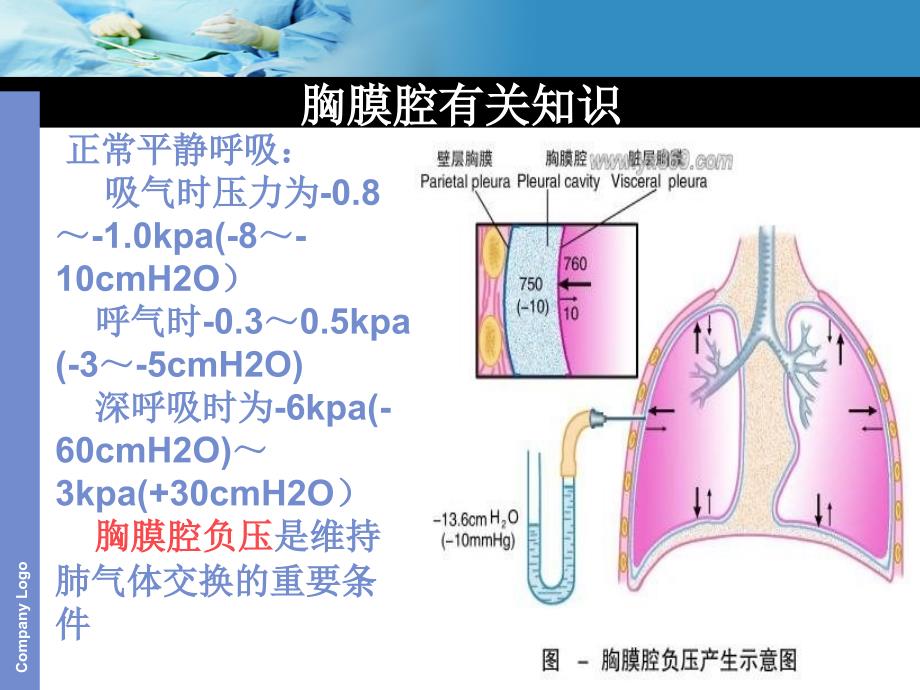 胸腔闭式引流.ppt_第4页