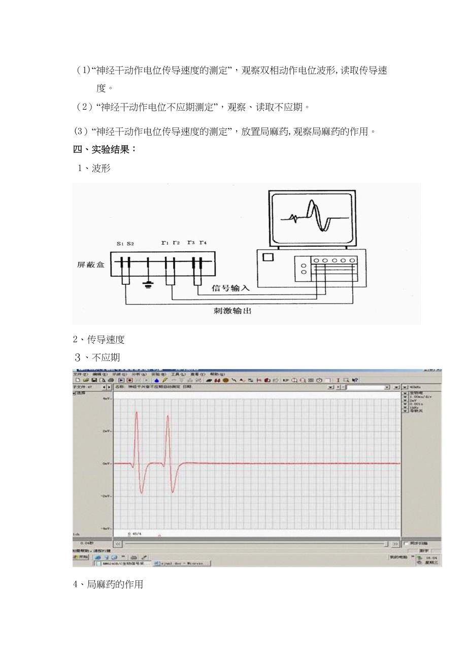 神经干动作电位及局麻药的作用_第2页