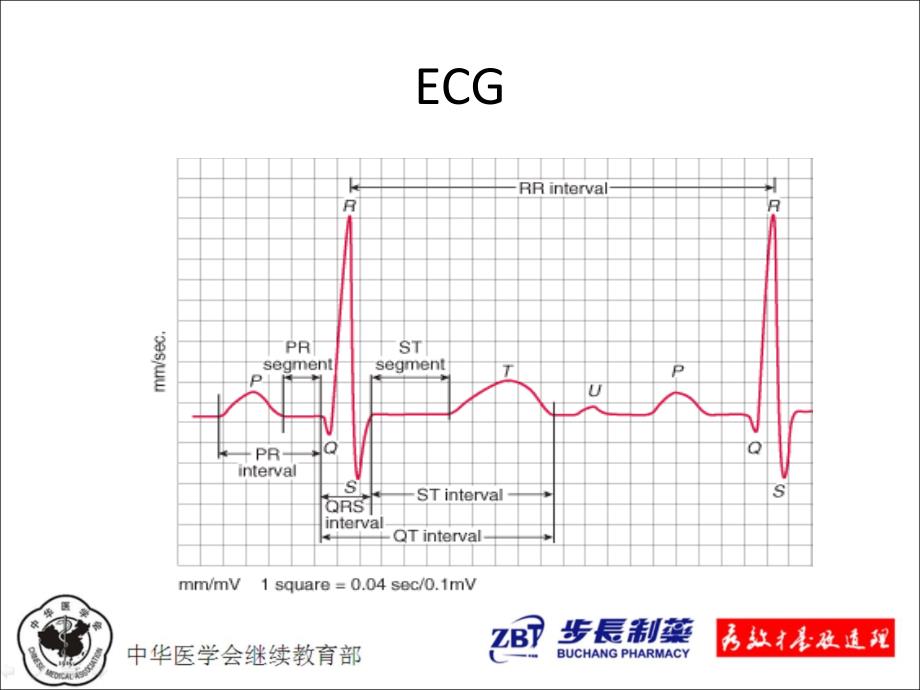 心律失常的诊治_第4页