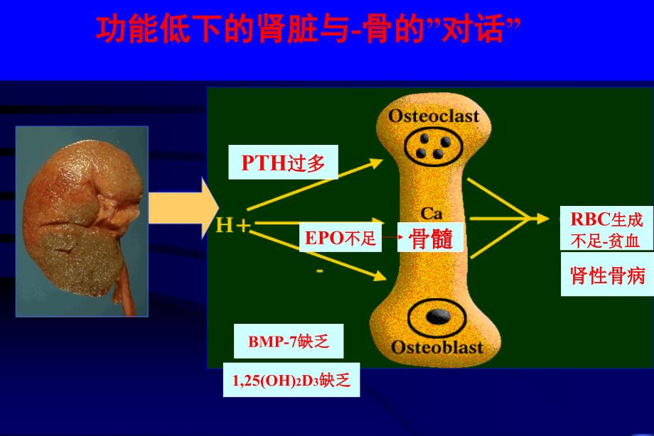 《慢性肾脏病骨病》PPT课件_第2页