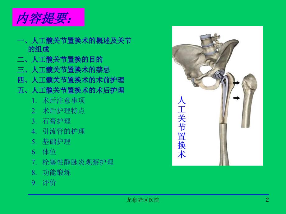 人工关节置换术术后护理讲义王莉_第2页