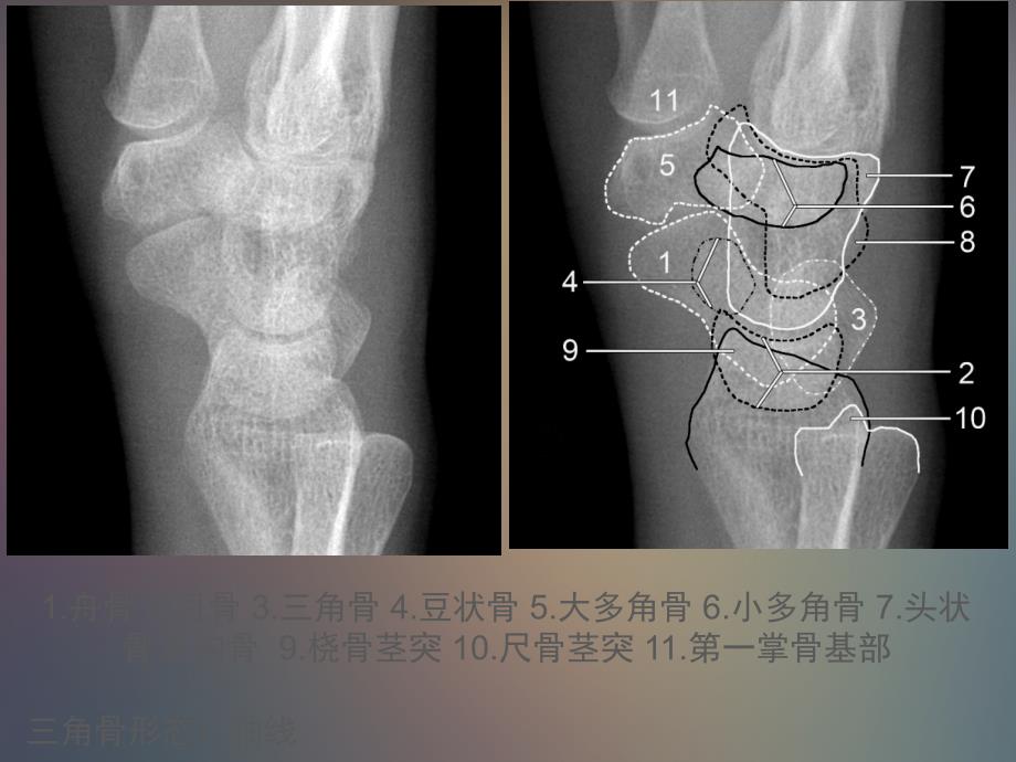 关节解剖ppt课件_第4页