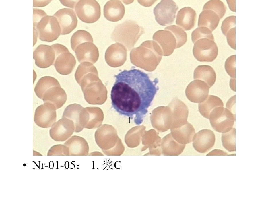 正常骨髓细胞复习精选文档_第5页