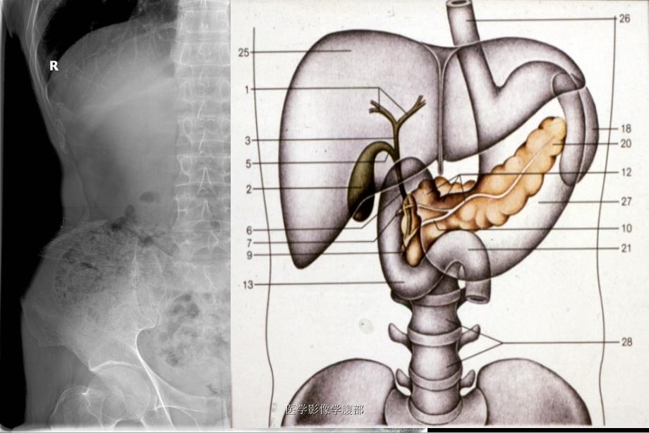 医学影像学腹部课件_第3页
