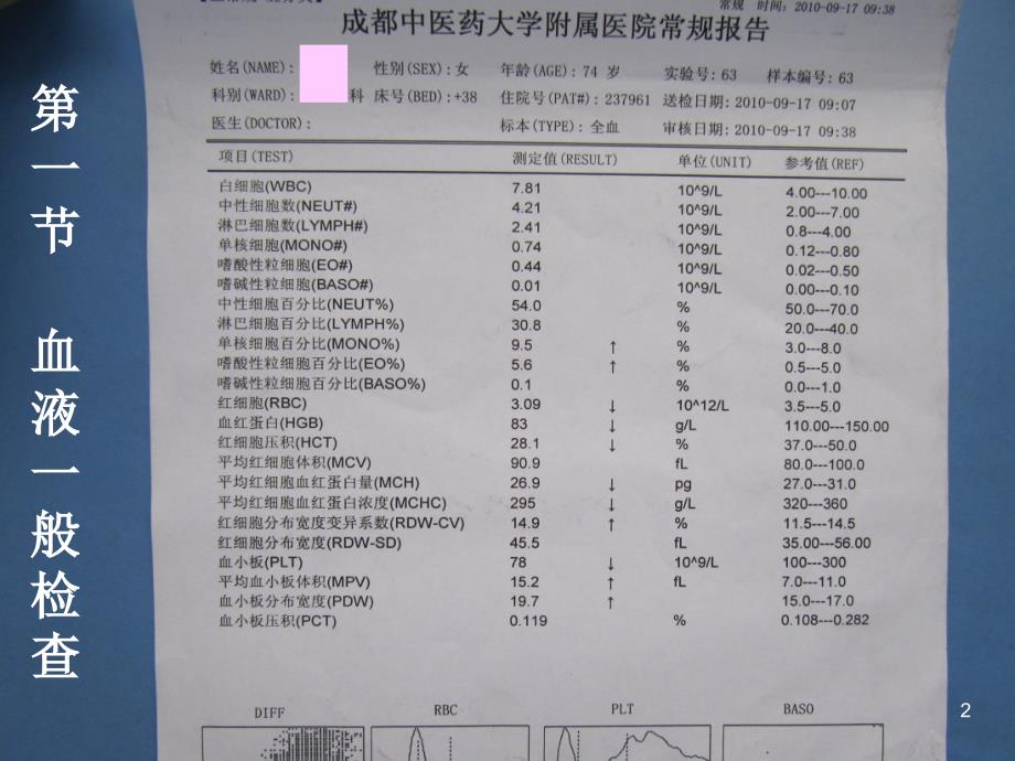 实验诊断血液检查骨髓细胞学检查ppt课件_第2页