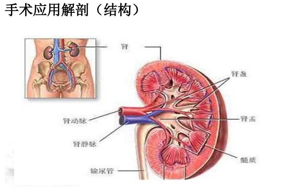 后腹腔镜肾部分切除术护理配合文档资料_第4页