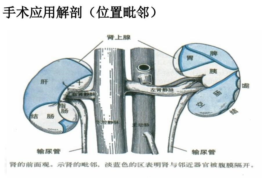 后腹腔镜肾部分切除术护理配合文档资料_第5页