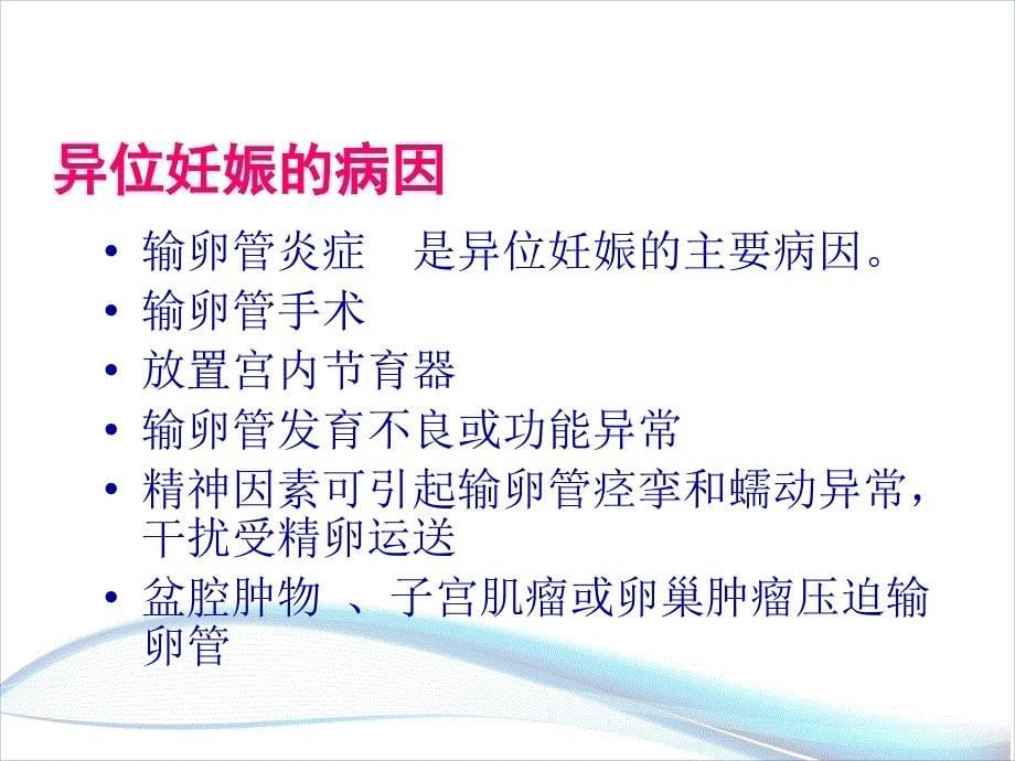 异位妊娠的护理小讲课.ppt_第5页