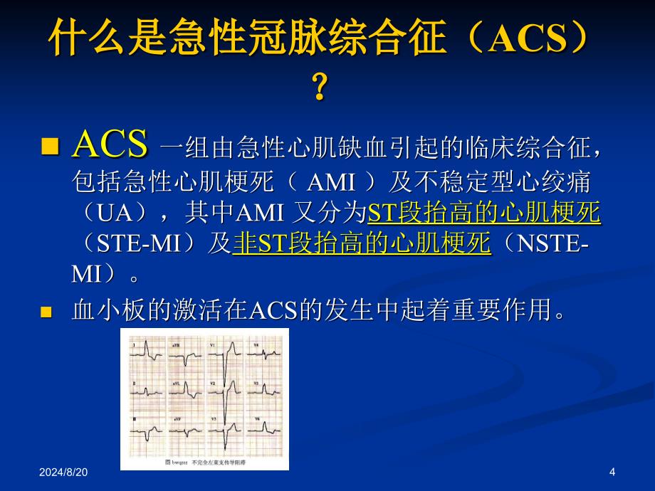 心肌损伤标志物检测的临床应用_第4页