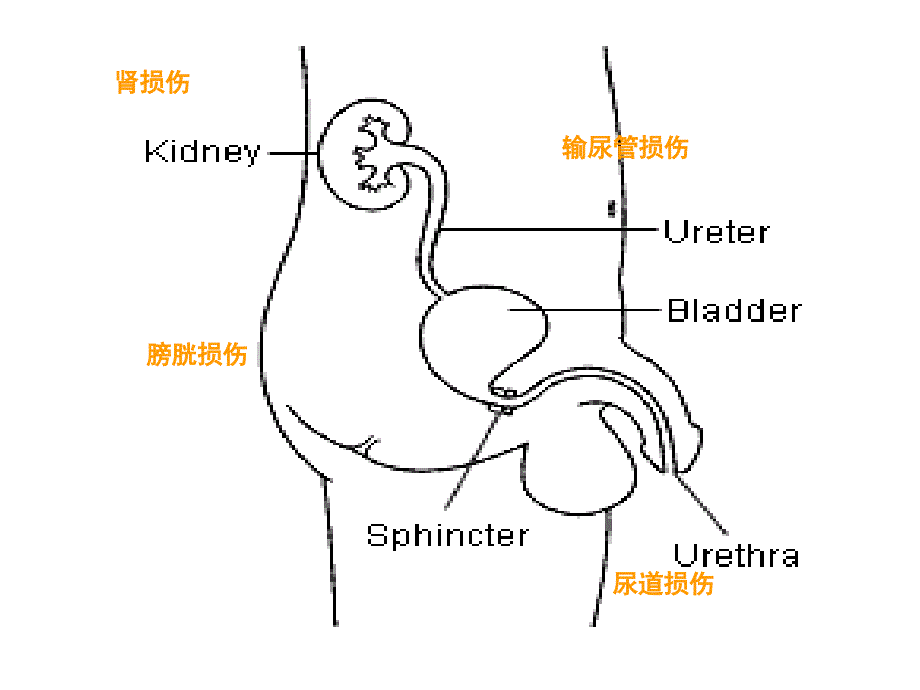 泌尿外科护理讲课ppt课件文档资料_第4页