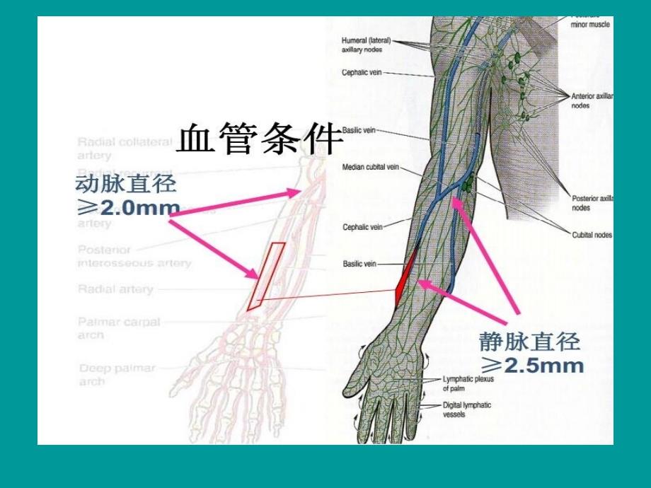 《血透通路内瘘相关》PPT课件_第4页