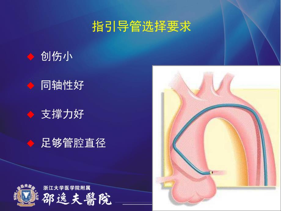 TRI指引导管的选择和操作技术_第4页