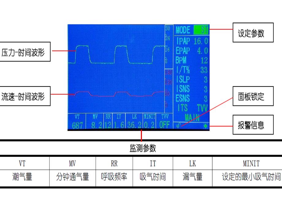 无创呼吸机Flexo应用_第2页