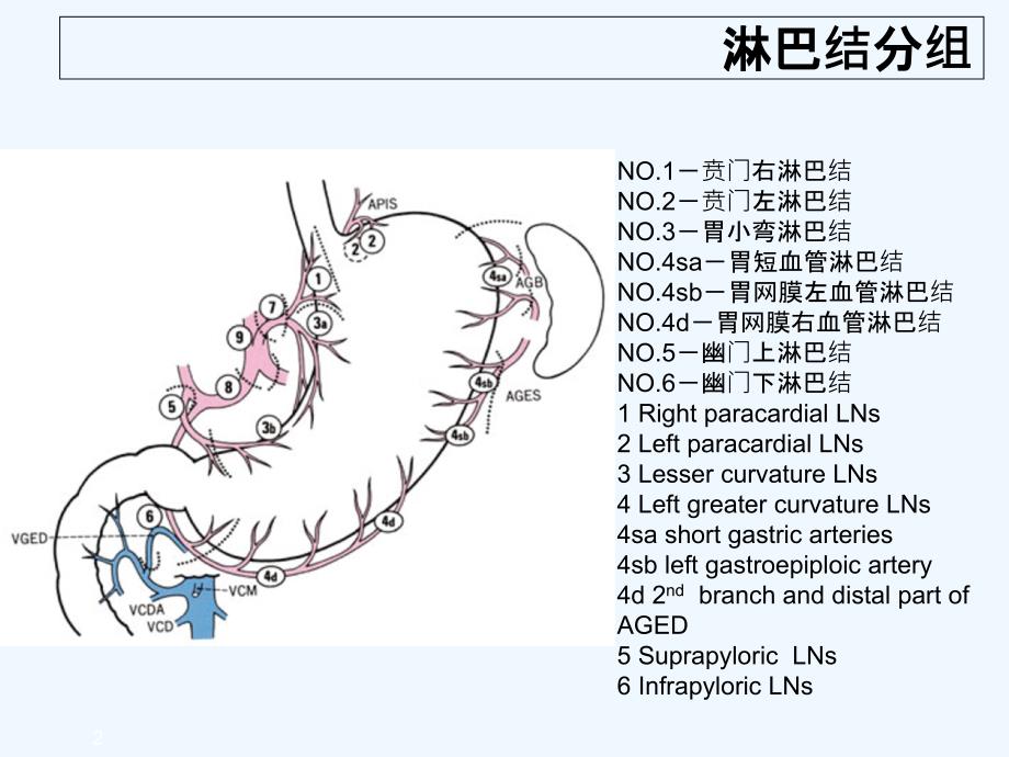 胃癌淋巴结转移CT阅片及相关知识点陈开波PP课件_第2页