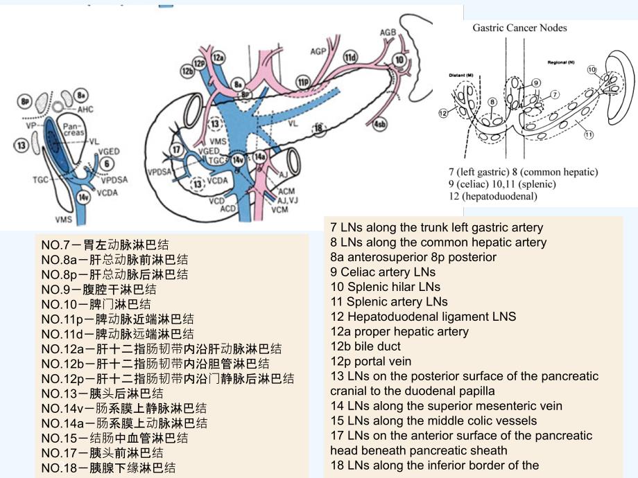 胃癌淋巴结转移CT阅片及相关知识点陈开波PP课件_第3页