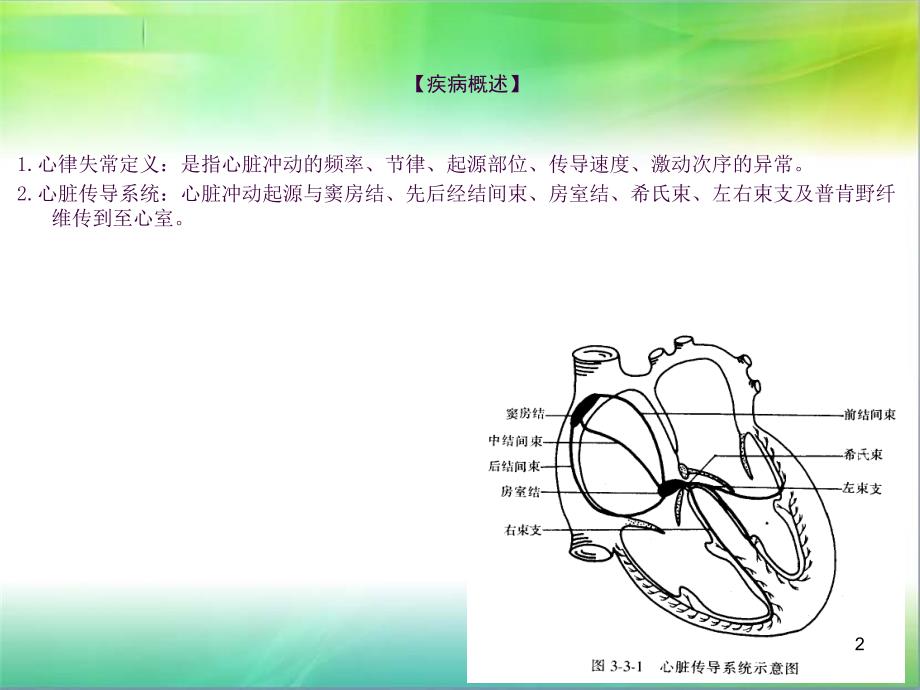 心律失常病人的护理查房ppt课件_第2页