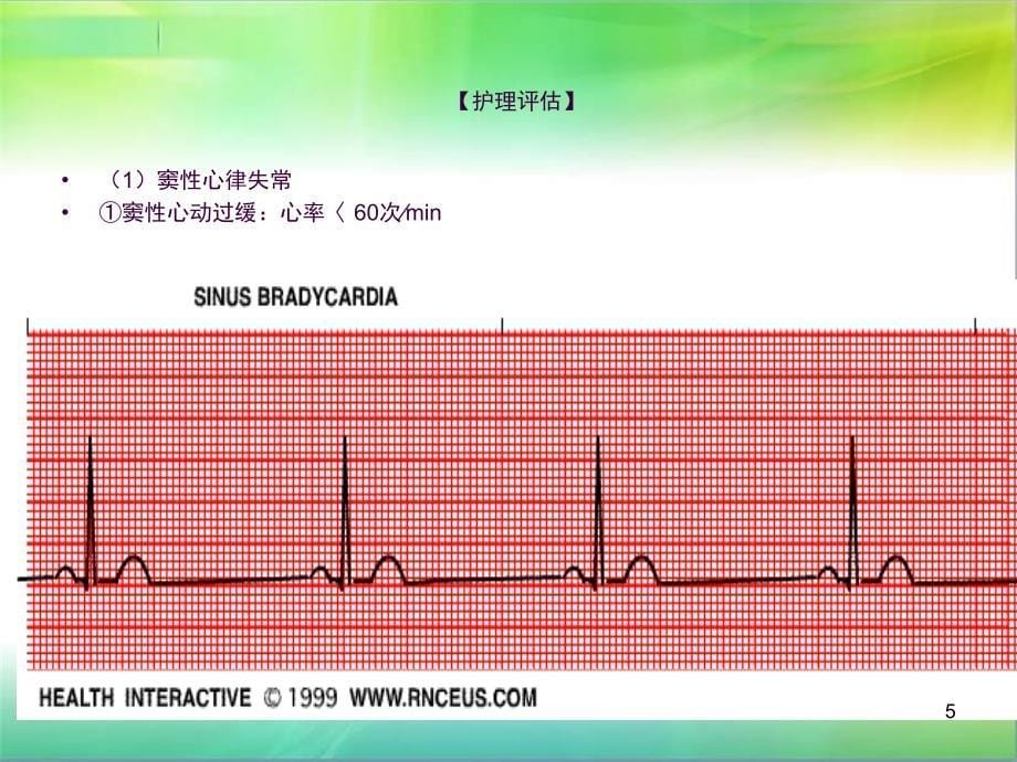 心律失常病人的护理查房ppt课件_第5页