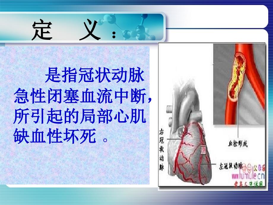 急性心肌梗死抢救护理PPT文档资料_第2页