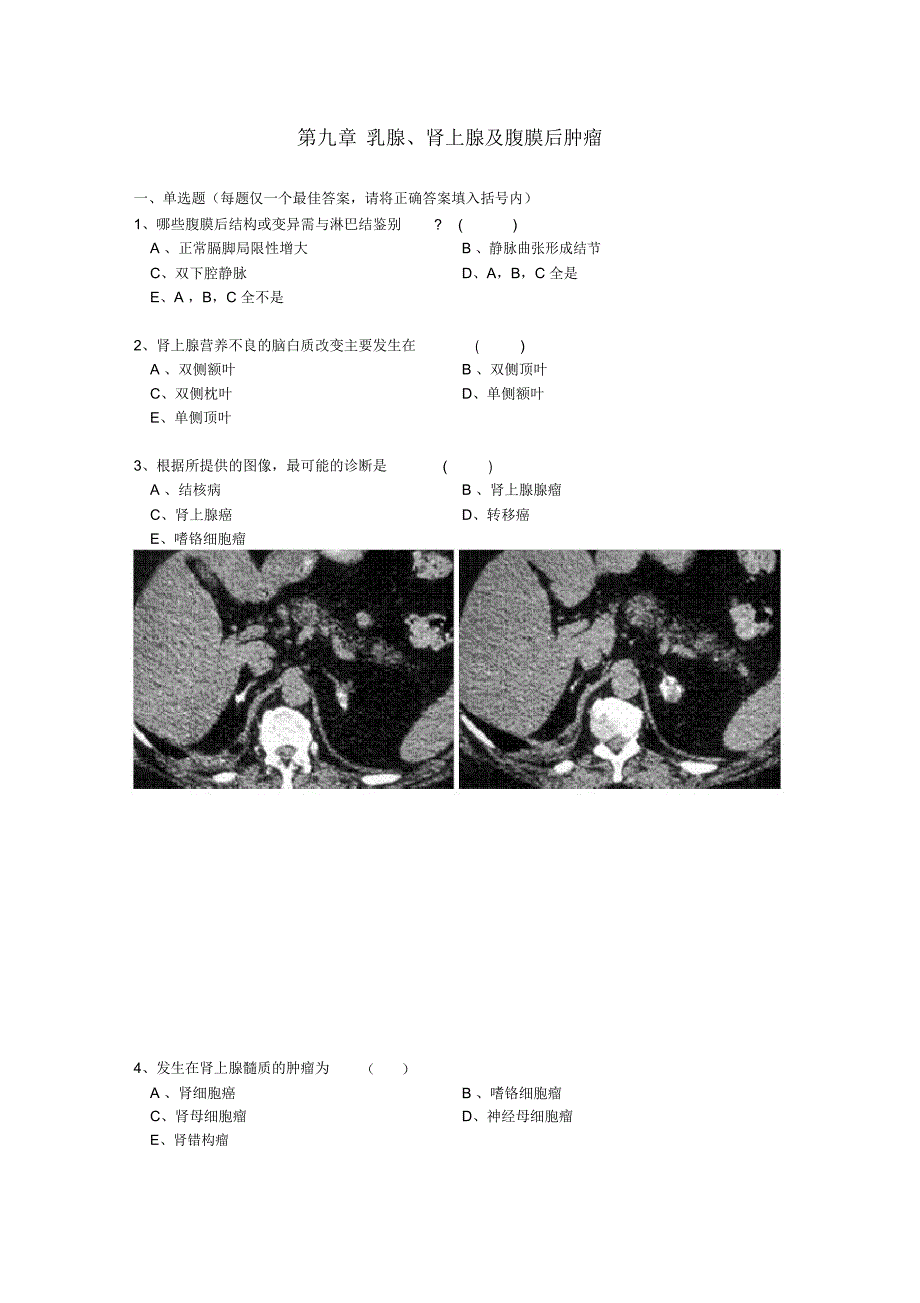 第九章乳腺肾上腺及腹膜后肿瘤_第1页