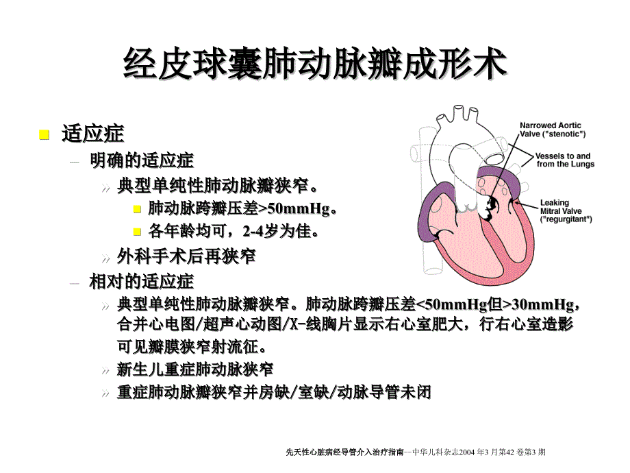 先心病的介入治疗适应症及病例选择ppt课件_第3页