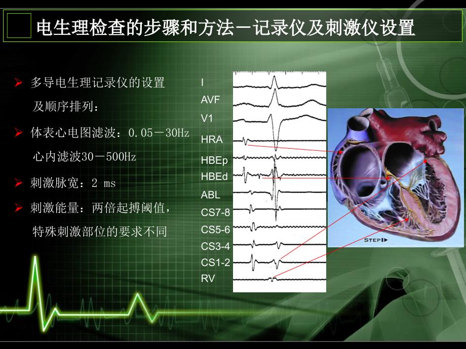 心内电生理检查方法及基本概念通用课件_第4页