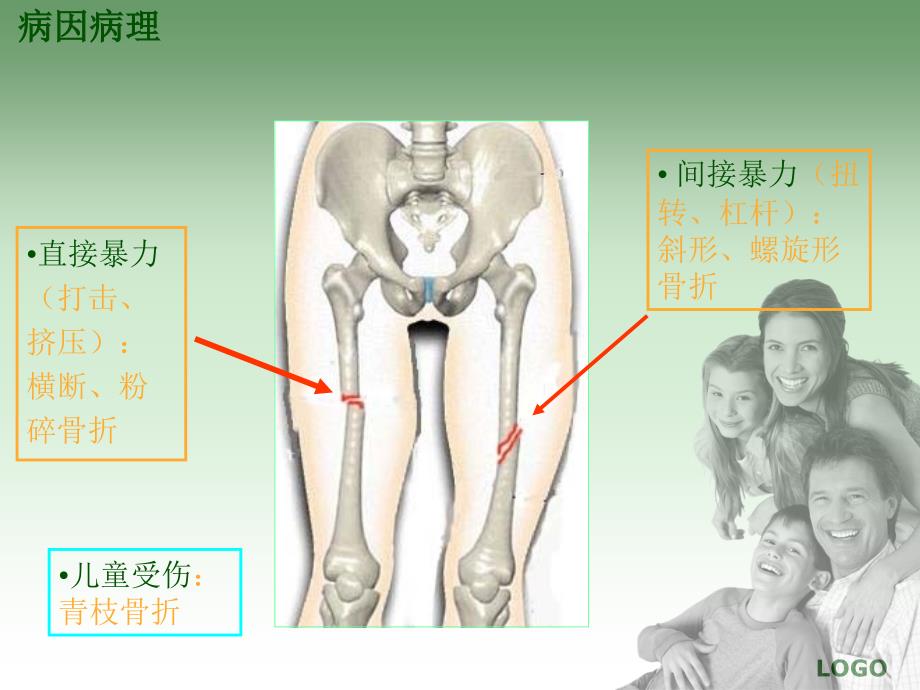 股骨干骨折的护理_第4页