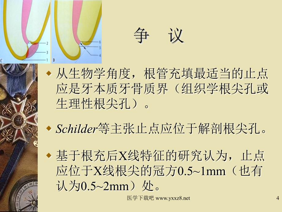 根管充填的长度和致密度.课件_第4页