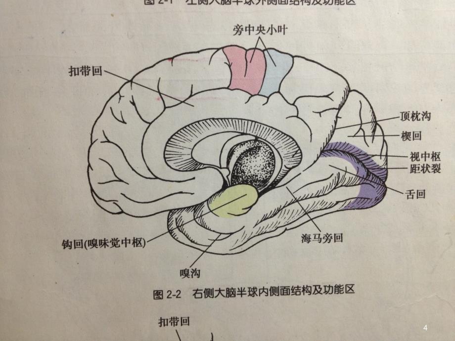 大脑半球病损表现及定位参考PPT_第4页