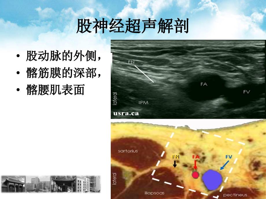 超声引导下股神经和坐骨神经支配_第4页