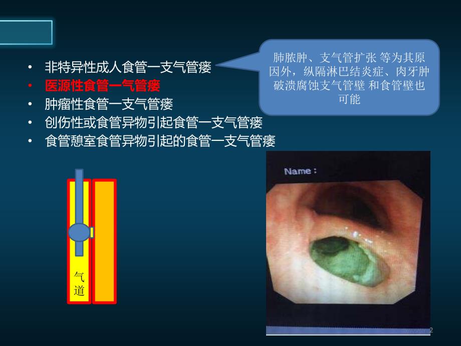 医源性气管食管瘘的防治医学PPT课件_第2页