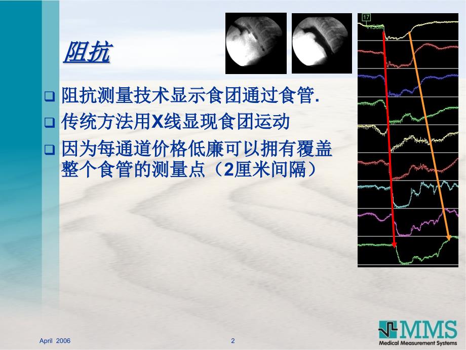 食管腔内ph阻抗压力测量技术ppt课件_第2页