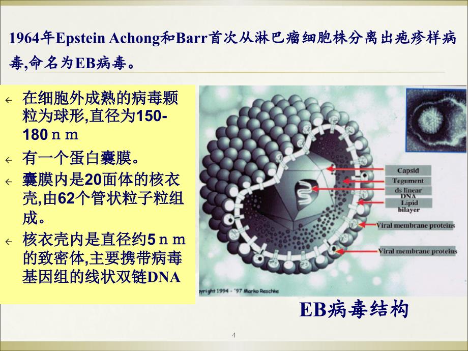 （医学课件）EBV病毒讲课_第4页