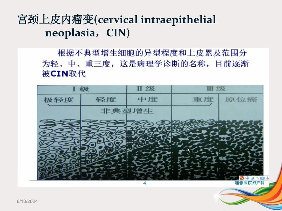 宫颈锥切术后切缘阳性的临床处理_第3页