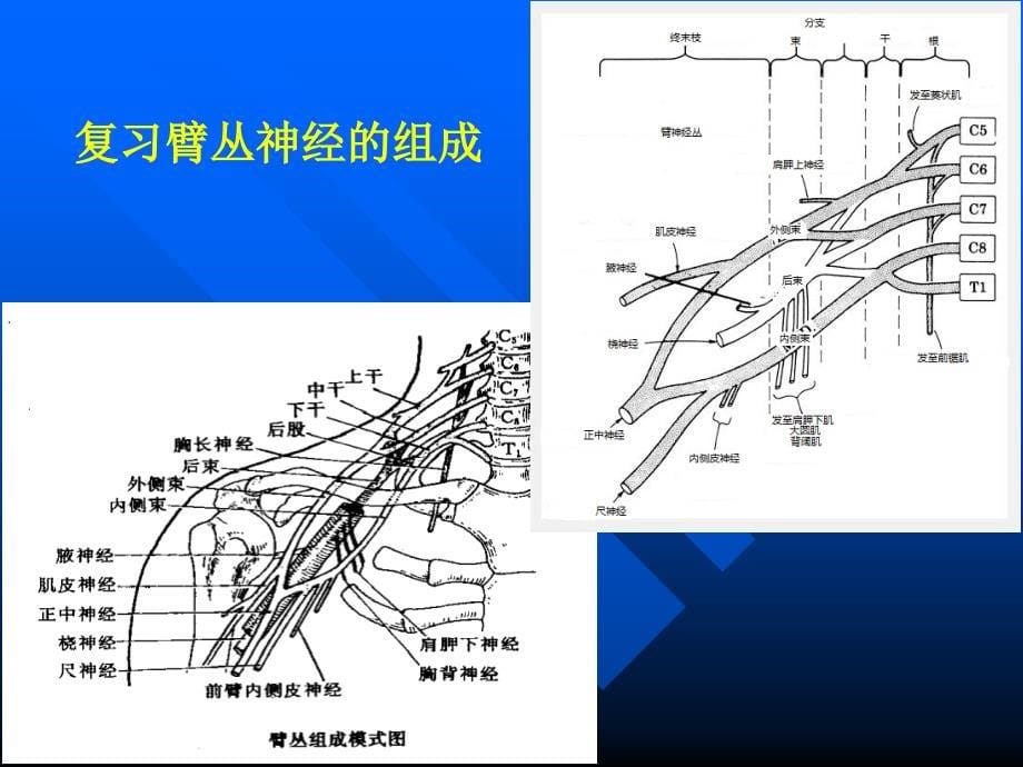 臂丛阻滞麻醉_第5页