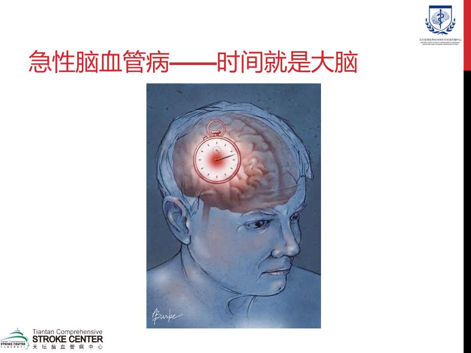 急性脑卒中医疗救治技术方案ppt课件_第2页