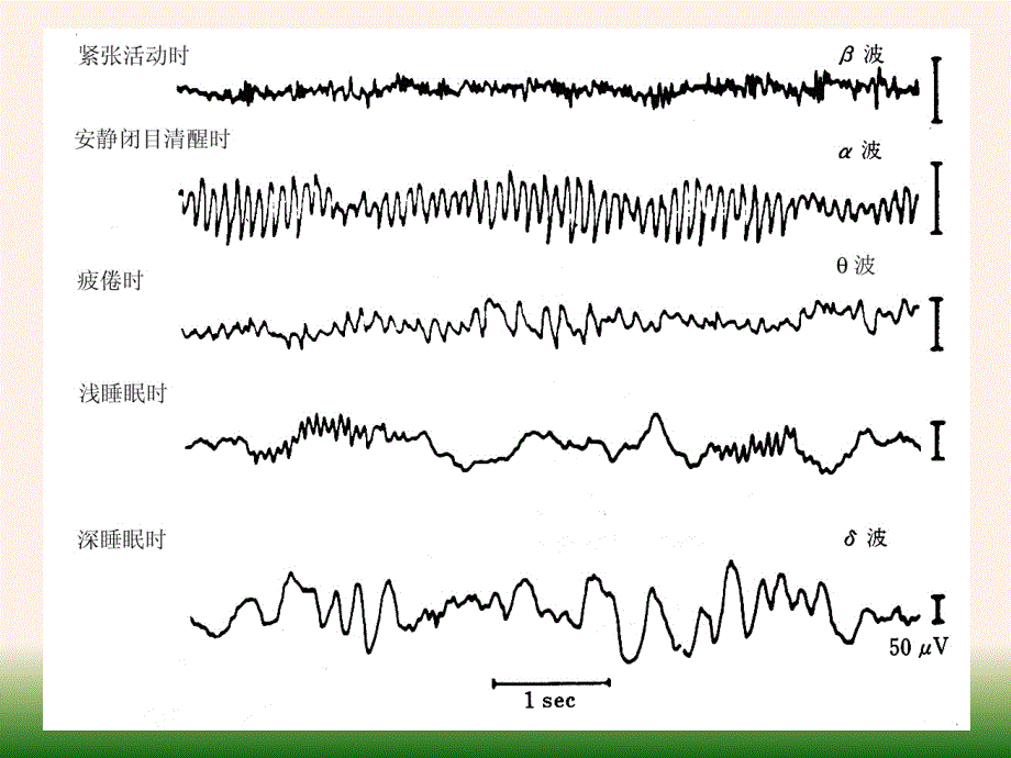脑电活动及睡眠和觉醒课件_第4页