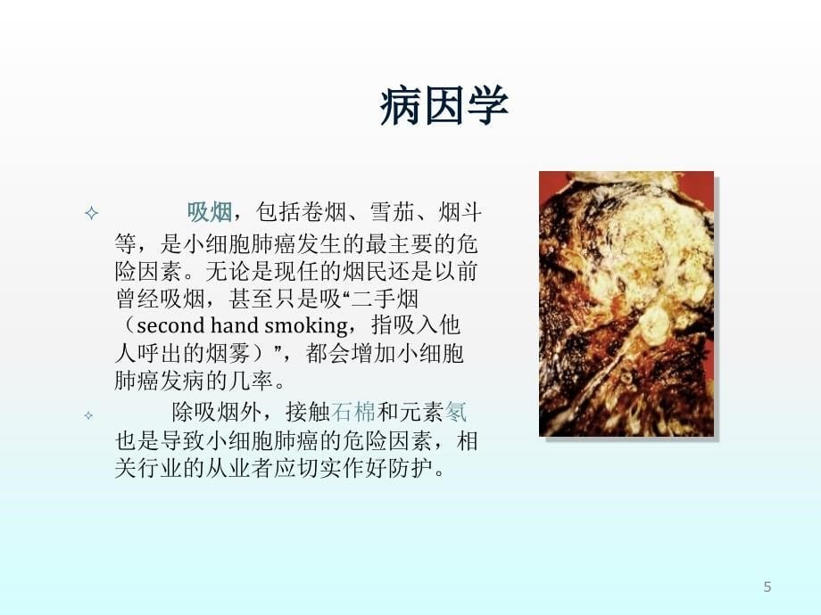 小细胞肺癌ppt课件_第5页