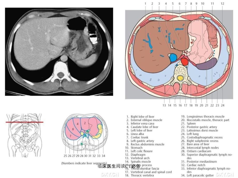 临床医生阅读CT必备课件_第2页