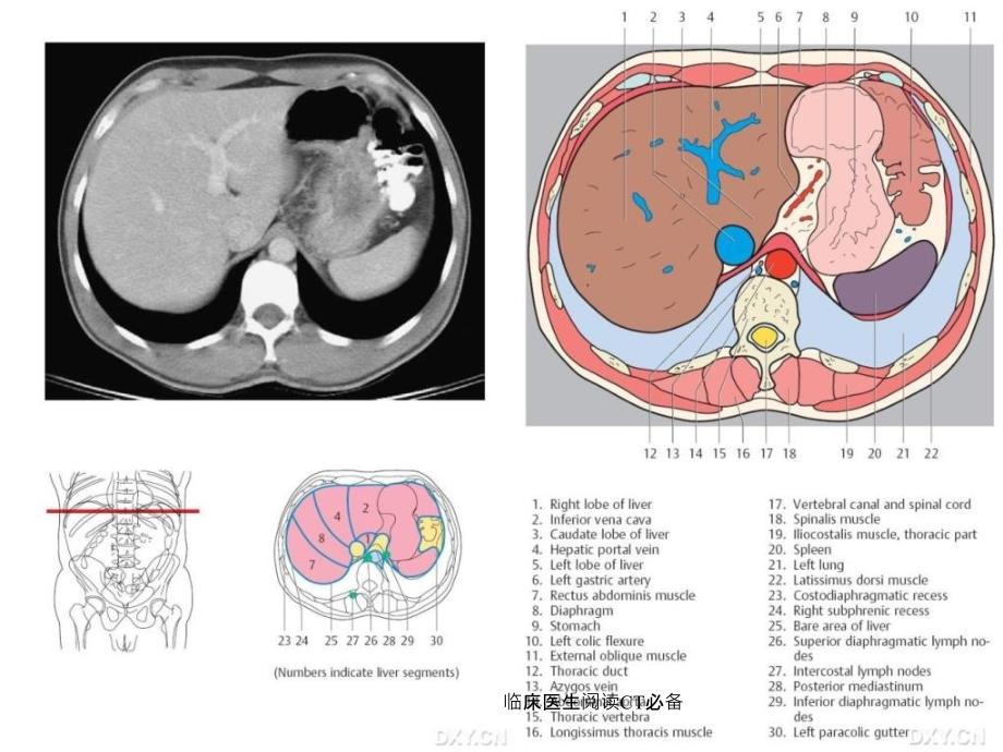 临床医生阅读CT必备课件_第3页