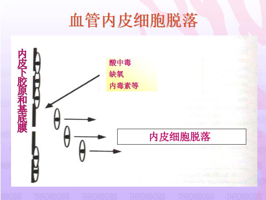 抗血小板药的临床选择课件幻灯_第4页