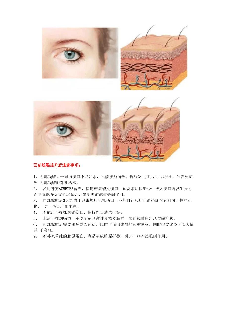 线雕提升几天能消肿为何我线雕二十天脸又肿了_第5页