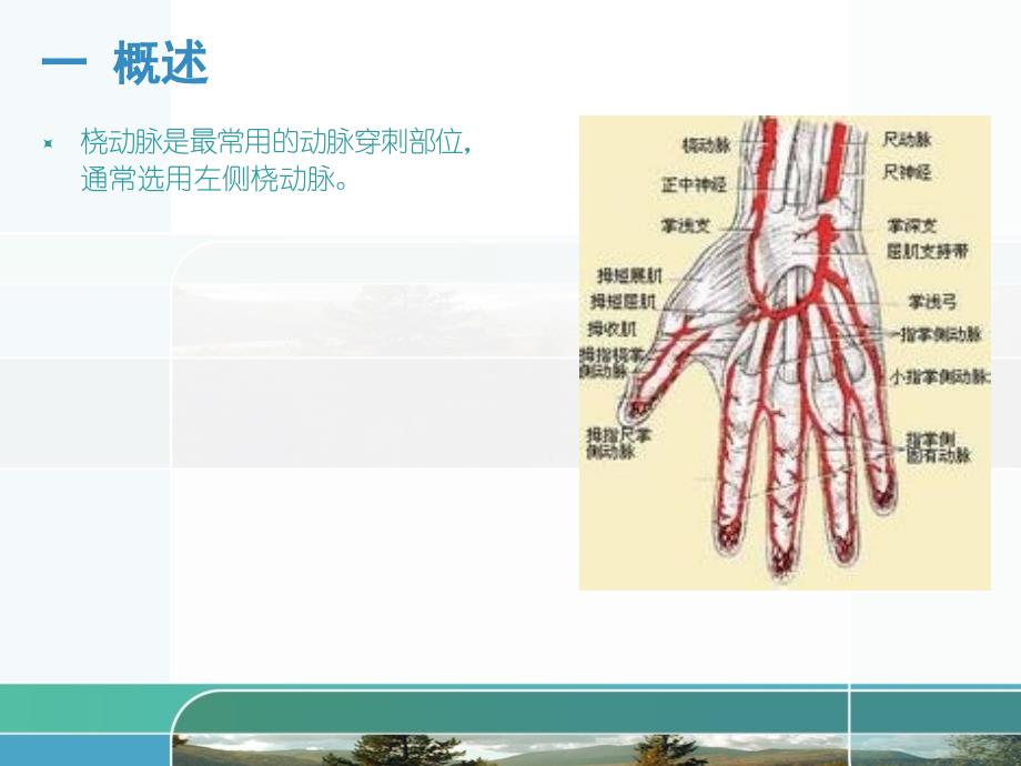 桡动脉穿刺操作专家共识_第2页