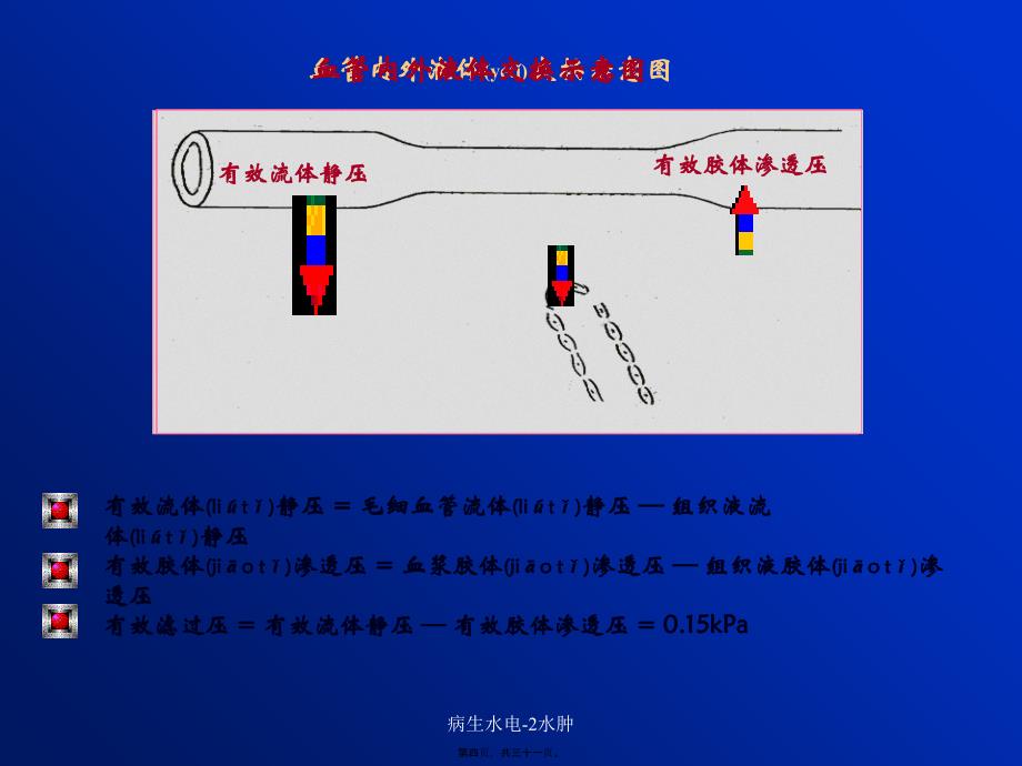 病生水电2水肿课件_第4页