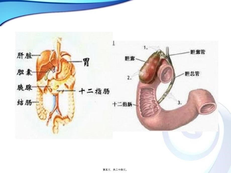 医学专题—十二指肠球部溃疡_第5页