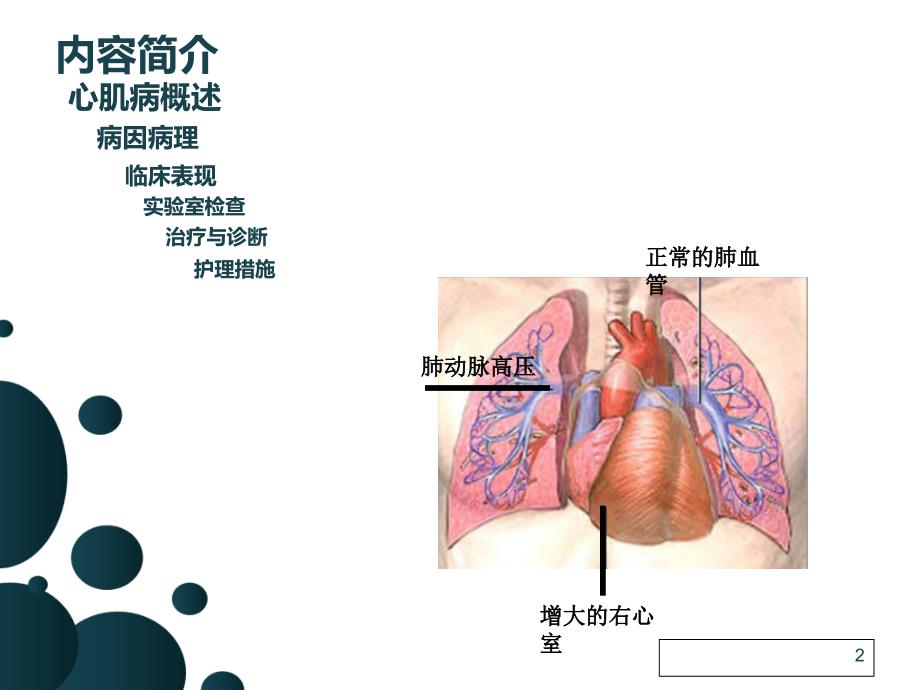 扩张性心肌病的护理查房张性1_第2页